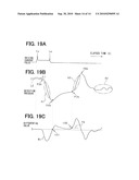 FUEL INJECTION DETECTING DEVICE diagram and image