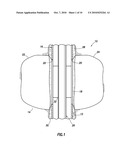 CASING DEFORMATION AND CONTROL FOR INCLUSION PROPAGATION diagram and image