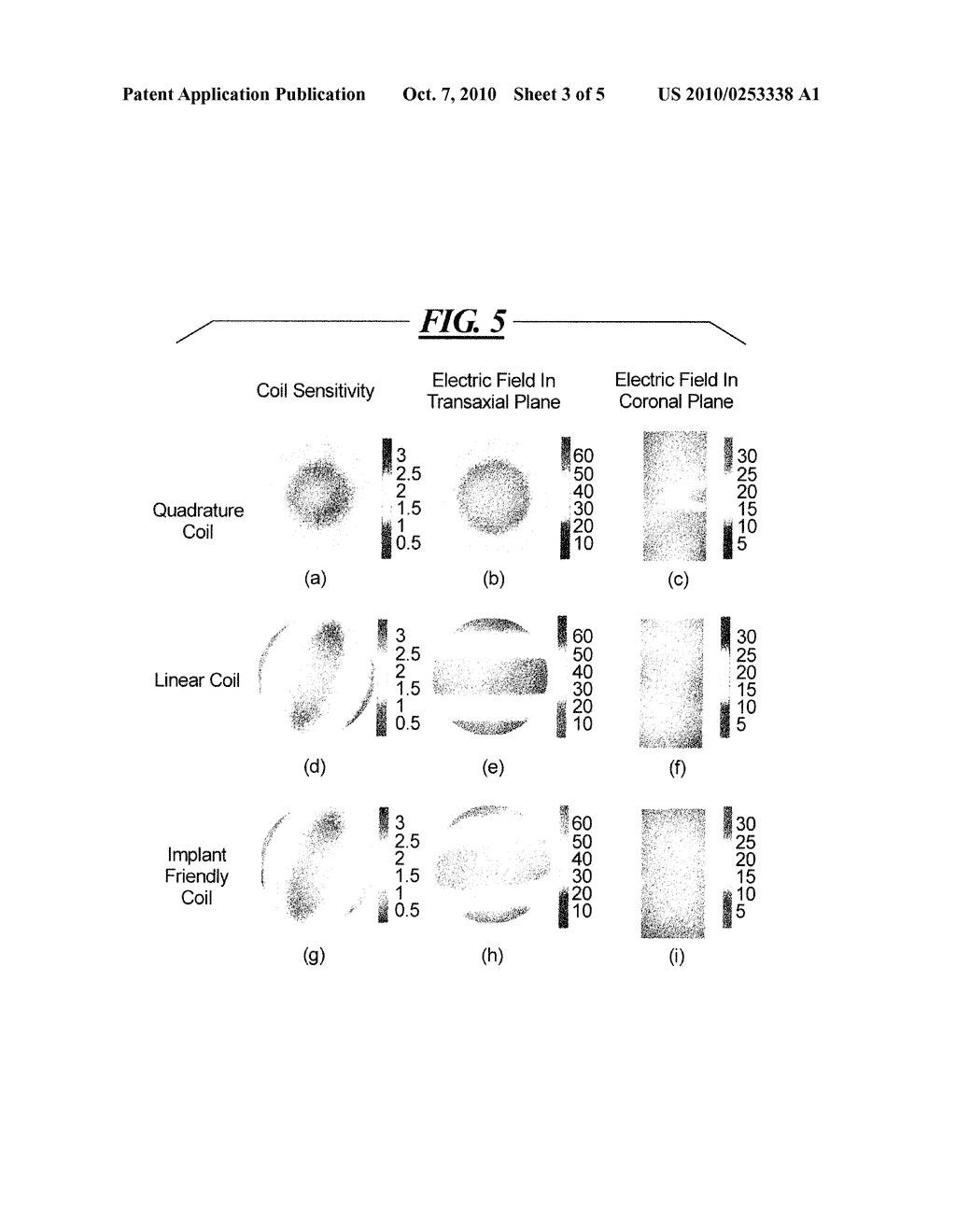 MAGNETIC RESONANCE METHOD AND APPARATUS FOR REDUCING RF HEATING IN THE PATIENT - diagram, schematic, and image 04