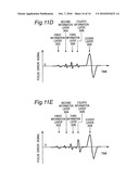 INITIALIZATION METHOD FOR INFORMATION RECORDING MEDIUM, INITIALIZATION APPARATUS FOR INFORMATION RECORDING MEDIUM, AND INFORMATION RECORDING MEDIUM diagram and image