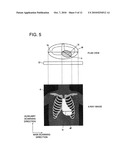 DYNAMIC RADIOGRAPHING SYSTEM diagram and image