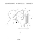 ORTHOVOLTAGE RADIOTHERAPY diagram and image