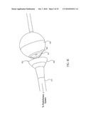 ORTHOVOLTAGE RADIOTHERAPY diagram and image