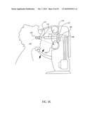 ORTHOVOLTAGE RADIOTHERAPY diagram and image