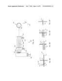 ORTHOVOLTAGE RADIOTHERAPY diagram and image