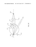 ORTHOVOLTAGE RADIOTHERAPY diagram and image