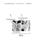 System and Method for Detecting Landmarks in a Three-Dimensional Image Volume diagram and image