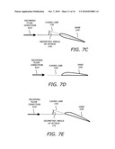 Turbofan engine noise suppression using fan flow deflector diagram and image