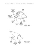 Turbofan engine noise suppression using fan flow deflector diagram and image