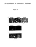 SYNERGISTIC TREATMENT OF CELLS THAT EXPRESS EPHA2 AND ERBB2 diagram and image