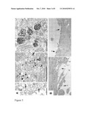 TRANSMEMBRANE PROSTATIC ACID PHOSPHATASE diagram and image