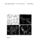 TRANSMEMBRANE PROSTATIC ACID PHOSPHATASE diagram and image