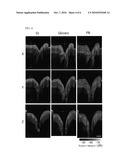 DENTAL DIAGNOSTIC SYSTEM BY MEANS OF OPTICAL COHERENCE TOMOGRAPHY diagram and image