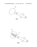 BIORESORBABLE INFLATABLE DEVICES, INCISION TOOL AND METHODS FOR TISSUE EXPANSION AND TISSUE REGENERATION diagram and image