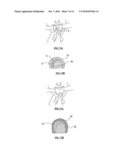 BIORESORBABLE INFLATABLE DEVICES, INCISION TOOL AND METHODS FOR TISSUE EXPANSION AND TISSUE REGENERATION diagram and image