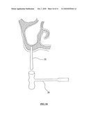 BIORESORBABLE INFLATABLE DEVICES, INCISION TOOL AND METHODS FOR TISSUE EXPANSION AND TISSUE REGENERATION diagram and image