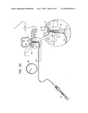 Implants, tools, and methods for sinus lift and bone augmentation diagram and image