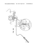 Implants, tools, and methods for sinus lift and bone augmentation diagram and image