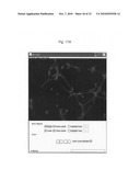 Methods of monitoring angiogenesis and metastasis in three dimensional co-cultures diagram and image