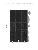 Methods of monitoring angiogenesis and metastasis in three dimensional co-cultures diagram and image