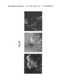 Methods of monitoring angiogenesis and metastasis in three dimensional co-cultures diagram and image