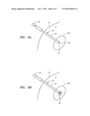RADIATION ABLATION TRACKING SYSTEM AND METHOD diagram and image
