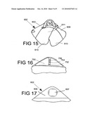 INFANT WRAP INCLUDING BODY PADDING diagram and image