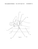 DEVICE AND METHOD FOR PREVENTING OR REDUCING SNORING AND/OR SLEEP APNEA diagram and image