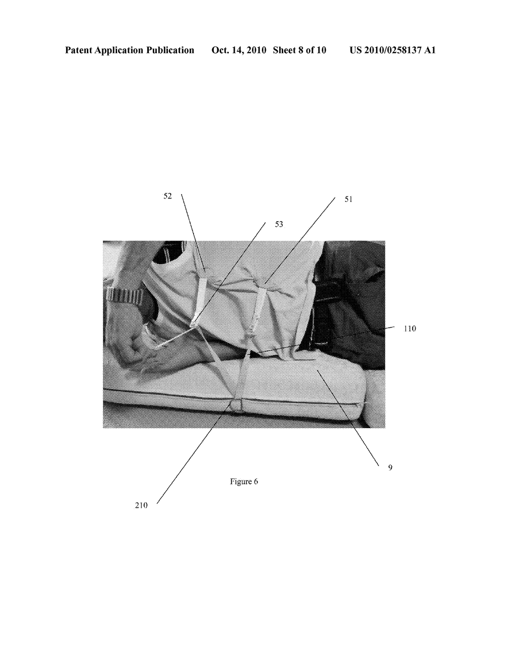 DEVICE AND METHOD FOR PREVENTING OR REDUCING SNORING AND/OR SLEEP APNEA - diagram, schematic, and image 09