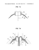 Lateral pipe-lining method and flange-pressing implement for lateral pipe-lining material used in the method diagram and image