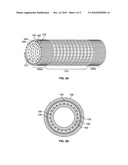 Well Screen Assembly With Multi-Gage Wire Wrapped Layer diagram and image