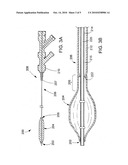 MEDICAL DEVICE COMPONENTS AND PROCESSES diagram and image