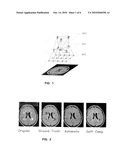  INTEGRATED SEGMENTATION AND CLASSIFICATION APPROACH APPLIED TO MEDICAL APPLICATIONS ANALYSIS diagram and image