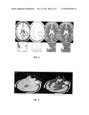  INTEGRATED SEGMENTATION AND CLASSIFICATION APPROACH APPLIED TO MEDICAL APPLICATIONS ANALYSIS diagram and image