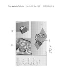 ORTHODONTIC TREATMENT MONITORING BASED ON REDUCED IMAGES diagram and image