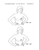 FLEXIBLE AND/OR ELASTIC BRACHYTHERAPY SEED OR STRAND diagram and image