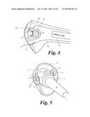 VIDEO LARYNGOSCOPE SYSTEM AND DEVICES diagram and image