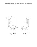 VIDEO LARYNGOSCOPE SYSTEM AND DEVICES diagram and image