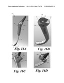 VIDEO LARYNGOSCOPE SYSTEM AND DEVICES diagram and image