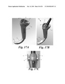 VIDEO LARYNGOSCOPE SYSTEM AND DEVICES diagram and image