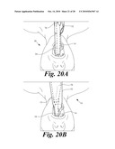 VIDEO LARYNGOSCOPE SYSTEM AND DEVICES diagram and image