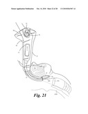 VIDEO LARYNGOSCOPE SYSTEM AND DEVICES diagram and image