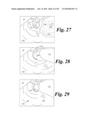 VIDEO LARYNGOSCOPE SYSTEM AND DEVICES diagram and image