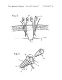 SKIN SEAL WITH INFLATABLE MEMBRANE diagram and image