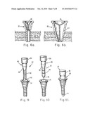 SKIN SEAL WITH INFLATABLE MEMBRANE diagram and image