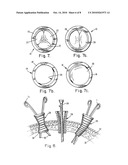 SKIN SEAL WITH INFLATABLE MEMBRANE diagram and image