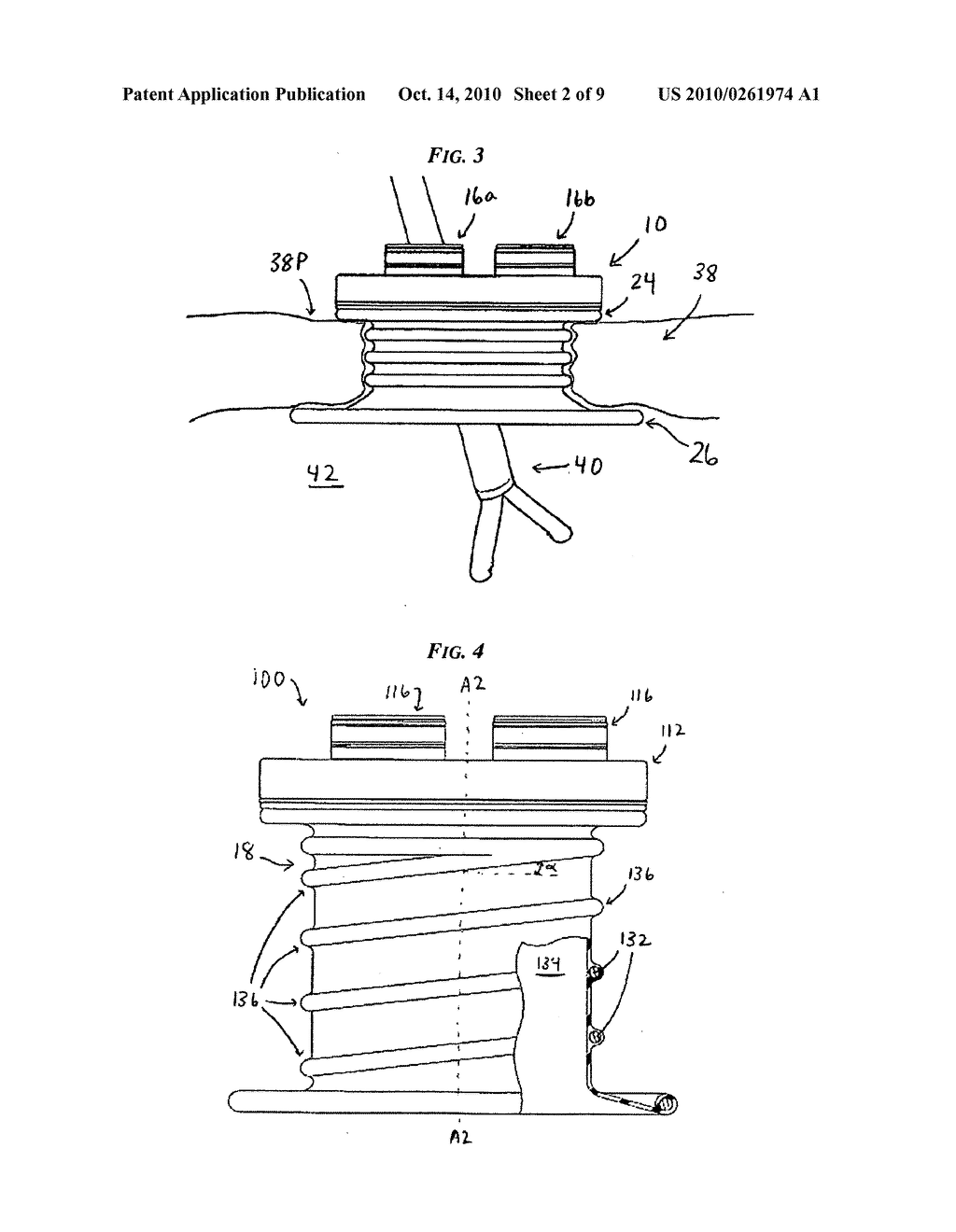 METHODS AND DEVICES FOR PROVIDING ACCESS INTO A BODY CAVITY - diagram, schematic, and image 03