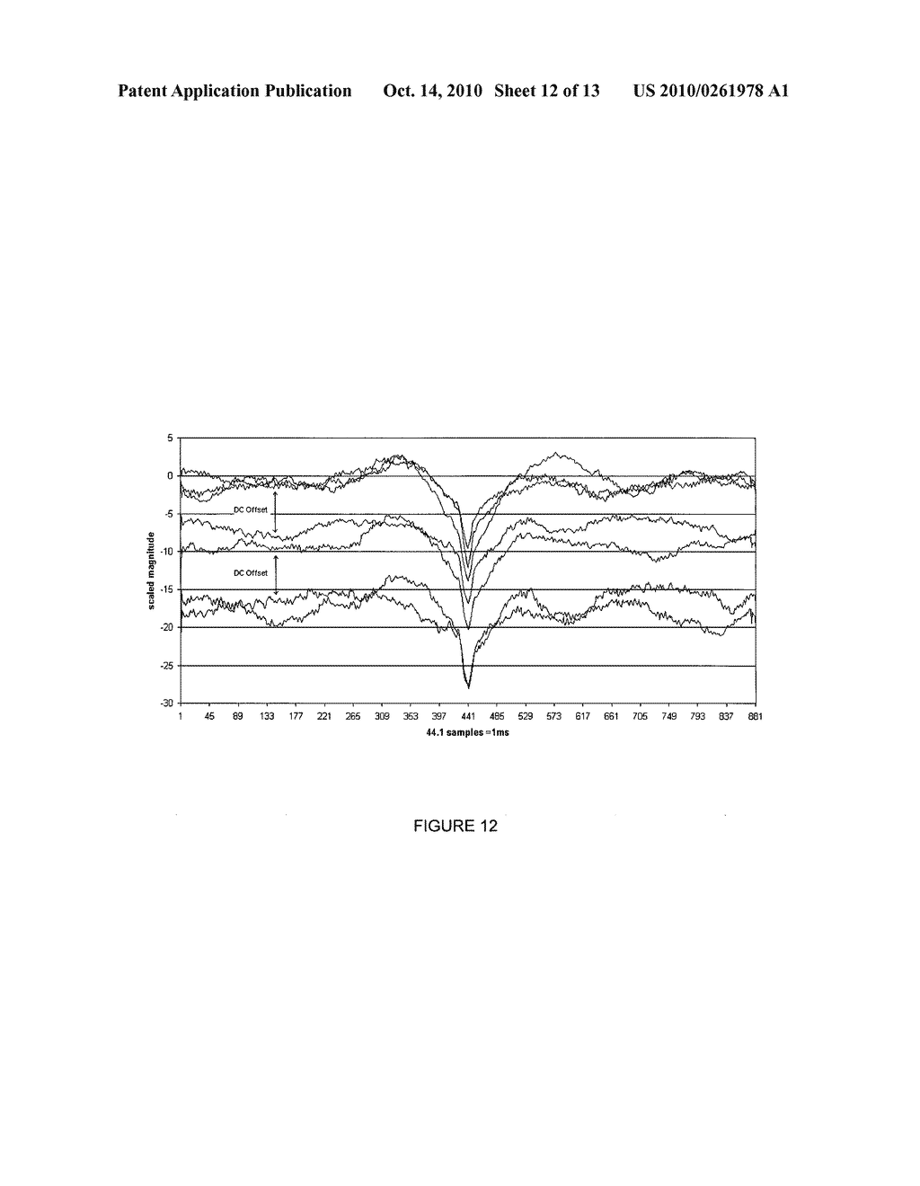 NEURAL RESPONSE SYSTEM - diagram, schematic, and image 13