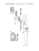 IMPLANTABLE DEVICES FOR DYNAMIC MONITORING OF PHYSIOLOGICAL AND BIOLOGICAL PROPERTIES OF TUMORS diagram and image