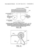 IMPLANTABLE DEVICES FOR DYNAMIC MONITORING OF PHYSIOLOGICAL AND BIOLOGICAL PROPERTIES OF TUMORS diagram and image